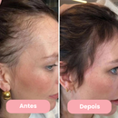 AlluHair - Escova de Terapia Capilar 4 em 1