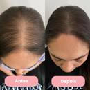 AlluHair - Escova de Terapia Capilar 4 em 1